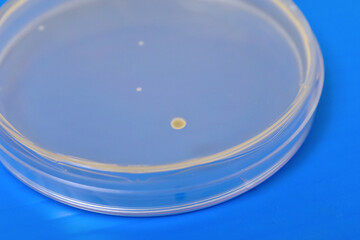 Colonies of bacteria growth on agar plate medium in laboratory.