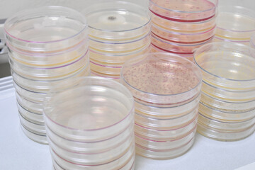 Colonies of bacteria growth on agar plate medium in laboratory.	