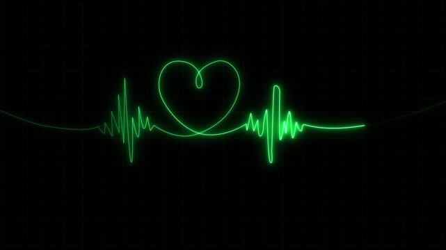 Green EKG waves showing a strong heartbeat on a hospital monitor 4k
