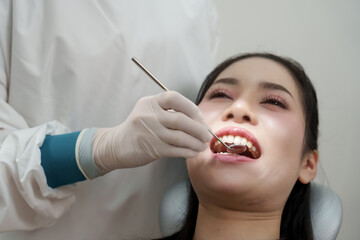 Female patient undergoing dental examination by assistant in white coat and gloves. Dental mirror and scaler used to inspect teeth for plaque and tartar buildup before cleaning procedure.