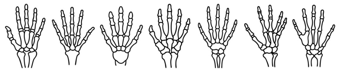 Skeletal hands multiple variations black and white drawing illustration anatomical study