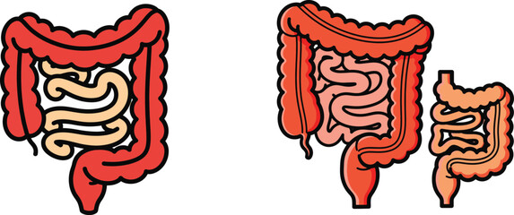 Human Intestines: Large and Small Intestine Diagram