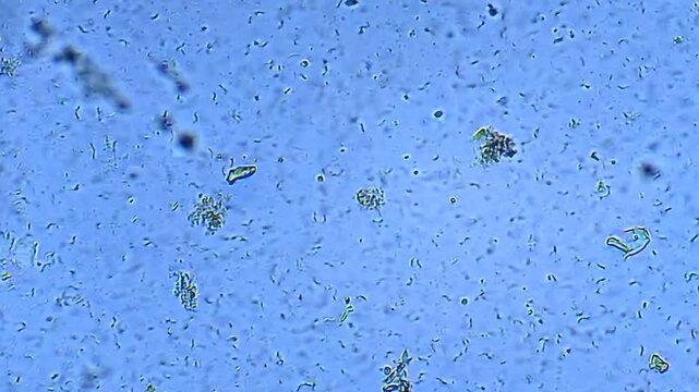 Micro organisms - Ciliates, microscope magnification