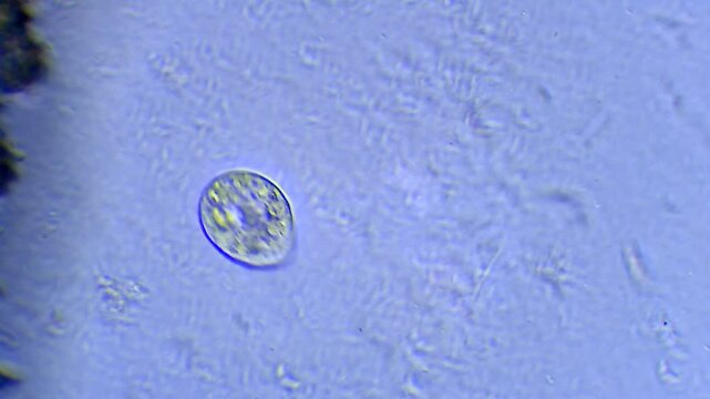 Micro organisms - Ciliates, microscope magnification