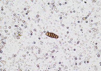 soil microorganisms under a microscope including amoeba, flagellates, nematodes, fungi, bacteria