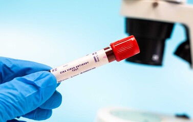 Naklejka premium Detects antibodies against the Zika virus, indicating past