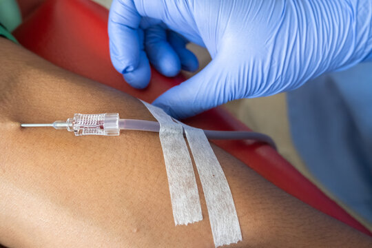 Close-up view of a healthcare professional securing an intravenous needle with adhesive tape on a patient’s arm during a medical procedure.