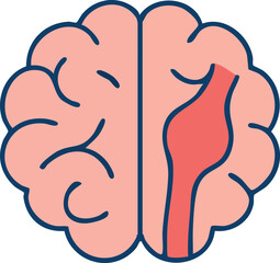 This is a flat vector illustration of a human brain with a highlighted red bulging blood vessel on the right side, representing a brain aneurysm.