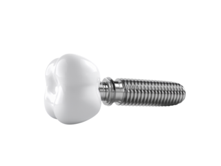 Precision crafted dental implant, showcasing modern restoration technology and medical advancement