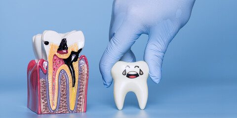 Dental model showing severe tooth decay alongside a cartoon tooth with a sad expression, held by a gloved hand on blue background.