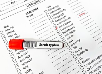 Blood sample tube positive result for scrub typhus.