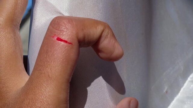 Footage of a brown-skinned man's bleeding index finger. Close-up motion videography of an injured finger. Workplace accident. Blood flowing motion. High Quality 4K Resolution