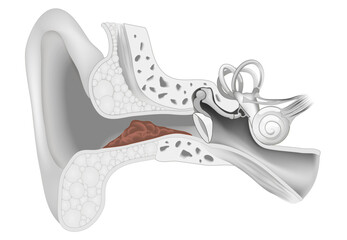 Earwax. Cross section of human ear