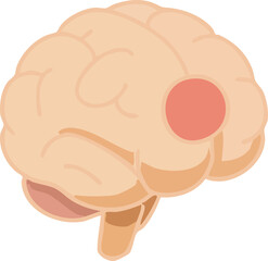 This illustration depicts a human brain with a highlighted red circular spot, symbolizing brain injury, stroke, or localized neurological damage.