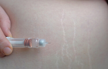 Close-up of a hand holding a weight loss drug near the skin and preparing for subcutaneous injection