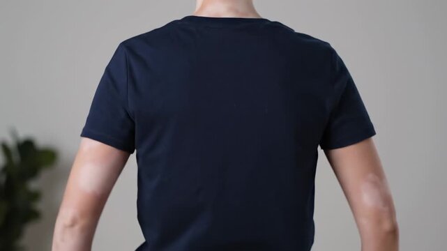 Person Showing Vitiligo Patches on Arms - Rear view of a person wearing a dark blue t-shirt, lifting the shirt to reveal patches of vitiligo on both arms.