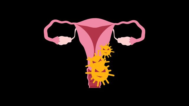 Ovarian cancer illustration animation. World ovarian cancer day concept	