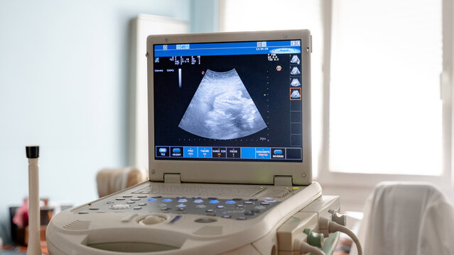 Ultrasound machine display in medical examination room