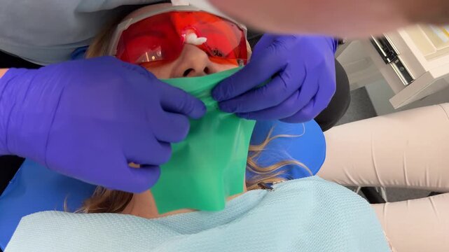 Dentist's hands in gloves with dental punch and cofferdam scarf. Dentist treats woman's tooth to patient with rubber dam. Modern dental office. Treatment elimination of caries, installation of filling