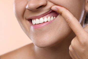 Fototapeta premium Woman showing her teeth and gums on beige background, closeup