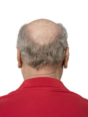 Isolated Back of old  Balding Man’s Head on transparent Background – Hair Loss Detail