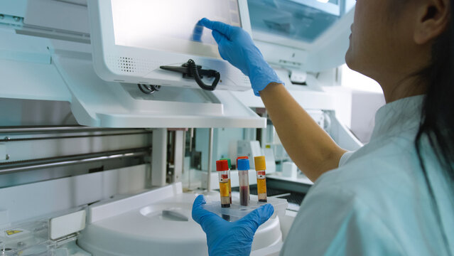 Woman lab technician wearing gloves carefully manages blood sample vials at a medical facility during testing procedures.