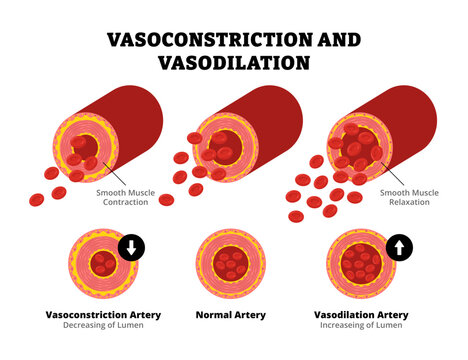 Arterial vasoconstriction and vasodilation diagram comparison with cross section view. Normal, constricted, and dilated blood vessels circulation. Cardiovascular reduction pressure. Healthcare Medical