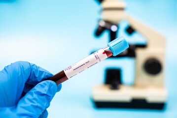 Naklejka premium Measures transferrin levels, a protein that transports iron,