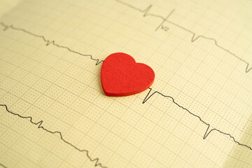 Electrocardiogram ECG, heart wave, heart attack, cardiogram report.