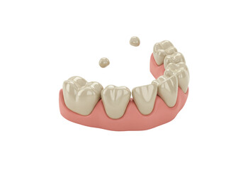 Isolated model of a human denture showing healthy gums, teeth, and missing filling