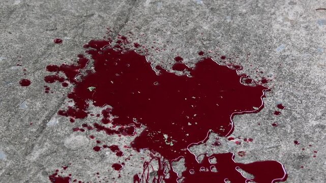 Blood dripped onto the floor.