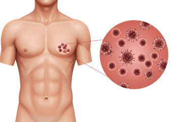 Male torso illustrating viral infection, microscopic view of viruses shown.
