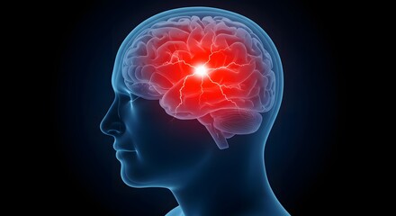 Intense headache or stroke in the human brain. Neurology and medical emergency concept. 3D illustration showing a painful electrical event or seizure in the head.