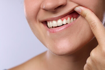 Obraz premium Woman showing inflamed gum on light background, closeup