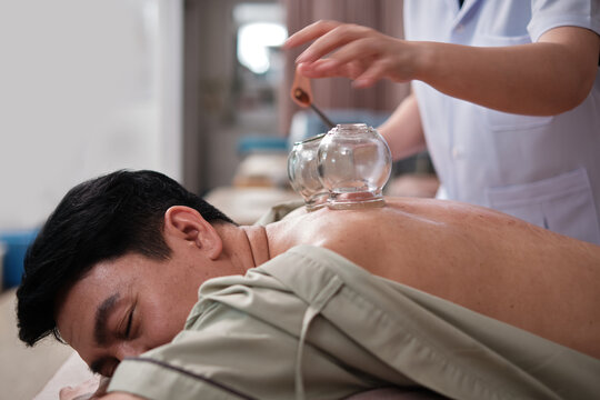 Asian male patient is treated for back pain with cupping therapy by female physiotherapist, passive healthcare, oriental traditional medical healing at spa clinic, and wellness massage lifestyle. - Powered by Adobe