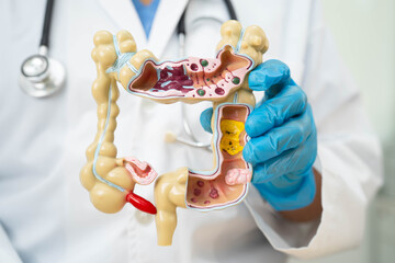 Intestine, doctor holding human anatomy model for study diagnosis and treatment in hospital.