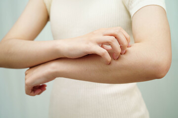 Asian woman itching of skin diseases using hand scratching.