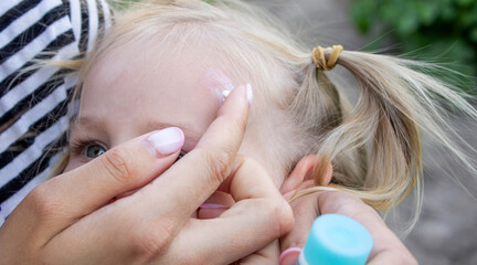Applying Cream to Child Forehead Insect Bite