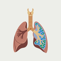 Medical Illustration of Bronchial Tree and Lung Structure for Respiratory Anatomy