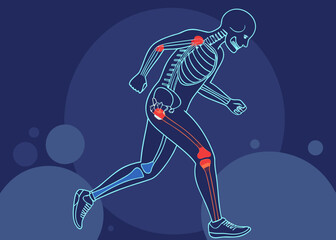 Obraz premium Human skeleton with highlighted joints indicating pain or injury