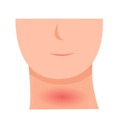 thyroid disease concept. vector illustration