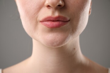Obraz premium Woman before cosmetic procedure on grey background, closeup