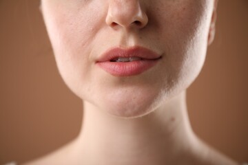 Fototapeta premium Woman before cosmetic procedure on brown background, closeup