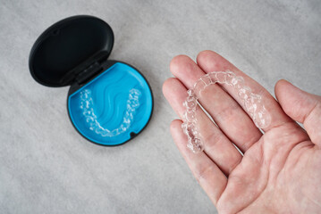 Clear dental aligner in hand and blue case on marble table. Dental orthodontic mouthpiece.