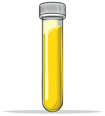Laboratory test tube with yellow liquid sample for medical analysis or scientific research