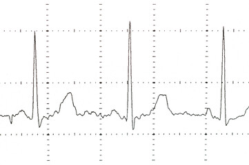 World Heart Rhythm Week concept. Electrocardiogram graph on paper. National Heart Health Month. World Heart Day awareness background.	