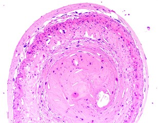 Microscopic view of a tissue section, exhibiting circular structures and stained in pink and purple hues