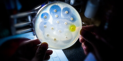 Antimicrobial susceptibility testing in petri dish. Microbiologist check Antibiotic resistance of...