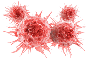 Cluster of abnormal, spiky cells.  Reddish-pink, magnified view.  Cells have  irregular shapes and  fibrous  projections