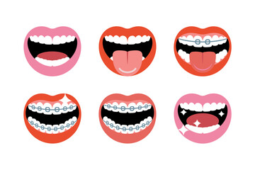 Playful mouth expressions pack, braces smiling teeth, tongue and open laugh, orthodontic variants, dental emoticons, cheeky oral character illustrations